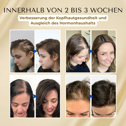 Timilk® VitaStrand Biotin Haarwachstumsspray-