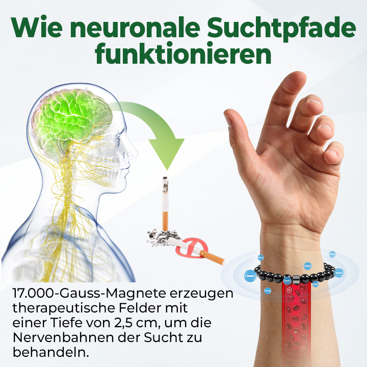 Czticle® AntiSmoke Magnetisches Armband ⚕️Unterbricht Nikotinsucht schnell – in nur 21 Tagen!