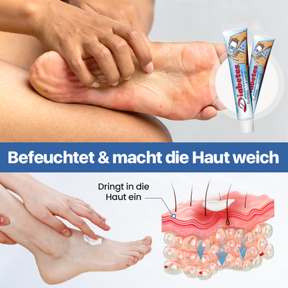 Biancat® VitaGluco Diabetes-Behandlungscreme✅Fördert schnellere Heilung diabetischer Wunden!
