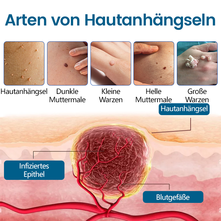 Timilk® DermaVenom RX+ Präzisions-Entfernungscreme