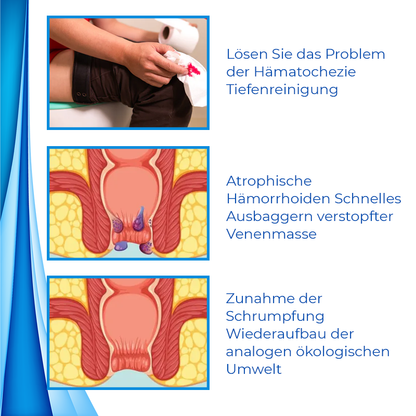 Biancat™ HemoEase Kräuter-Hämorrhoiden-Linderungscreme⭐