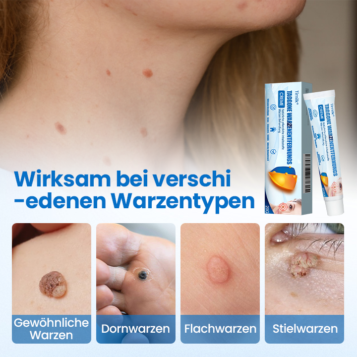 Timilk® TagGone Warzenentfernungscreme