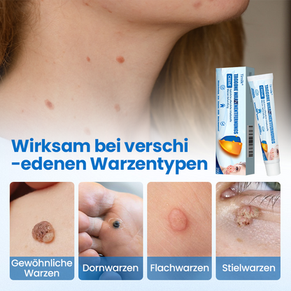 Timilk® TagGone Warzenentfernungscreme